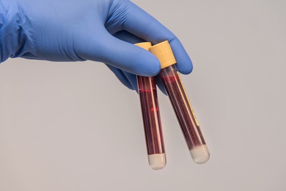 Prueba de sangre