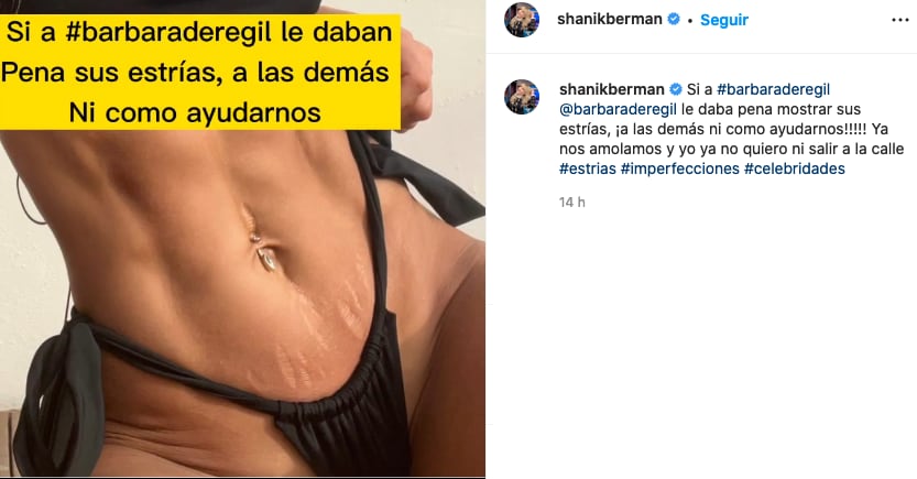 Shanik Berman contra Bárbara de Regil y sus estrías.