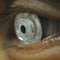 Crean lentes de contacto para hacer 'zoom' al parpadear