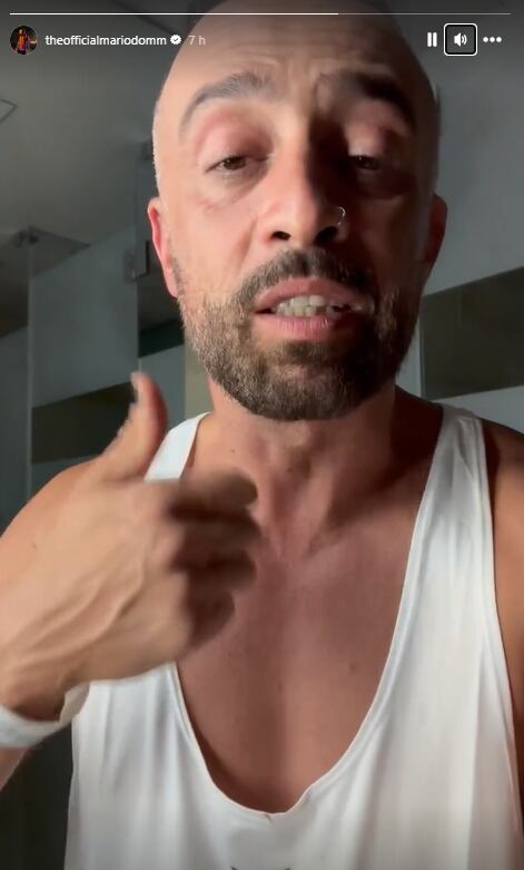 Mario Domm comparte porqué estuvo en el hospital.