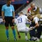 Karim Benzema sufre lesión; podría perderse la Eurocopa