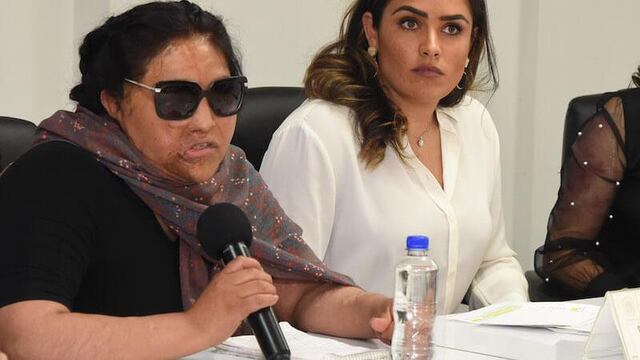 Carmen Sánchez, víctima de ataques con ácido busca tipificarlos como delito