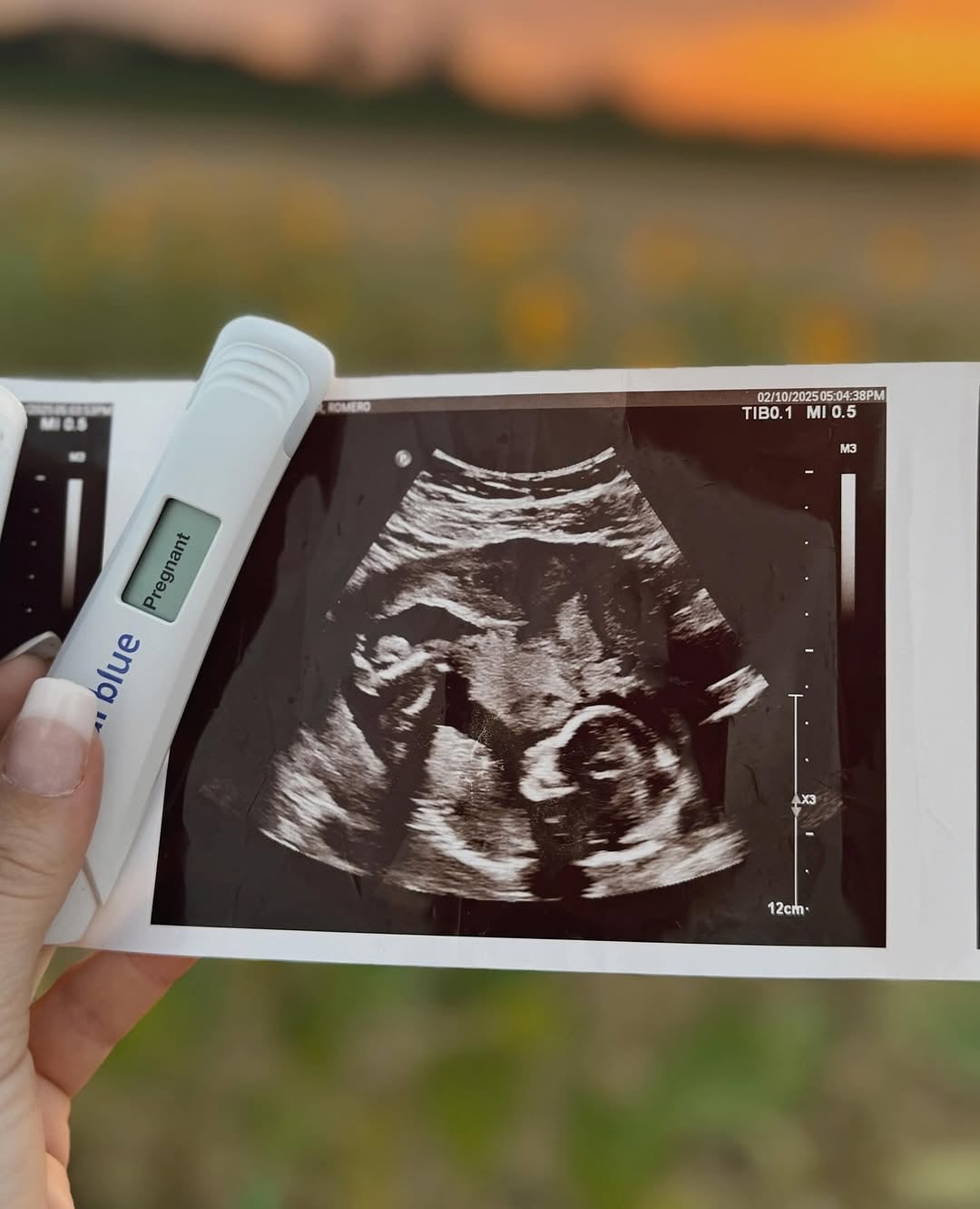 Lele Pons y Guaynaa anuncian embarazo de su primer bebé