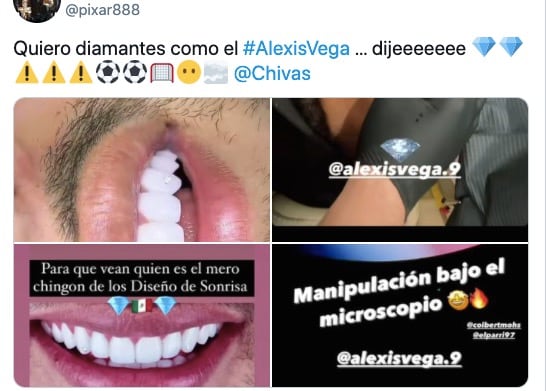 Dientes Alexis Vega