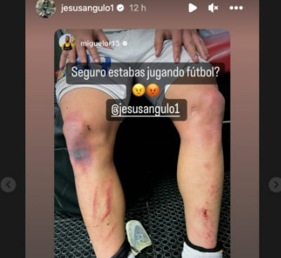 Las piernas de Jesús Angulo