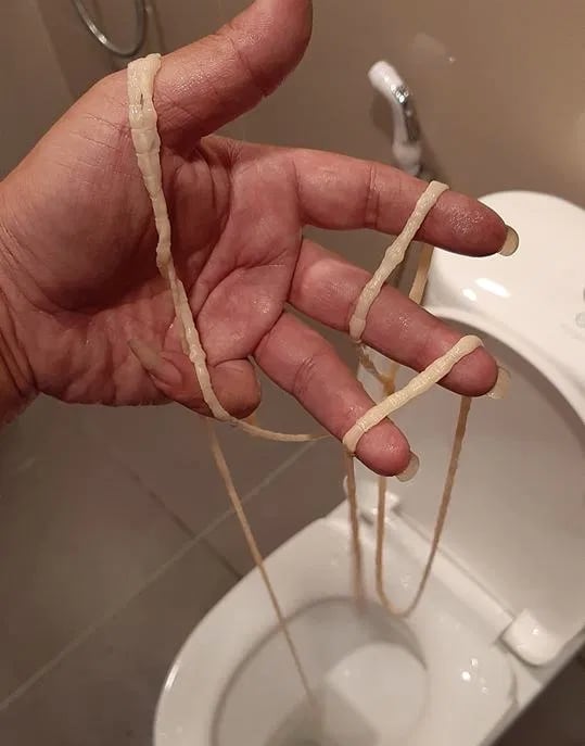 Se saca del trasero tenia de 10 metros