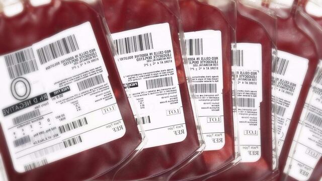 Transfusión sanguínea