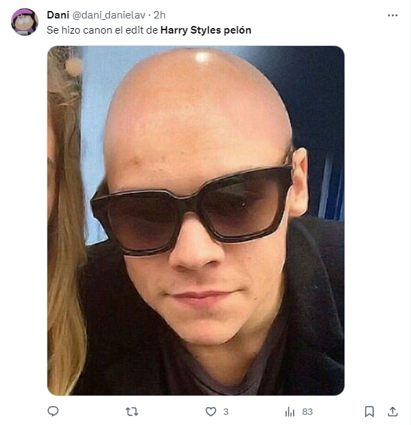 Memes por Harry Styles pelón