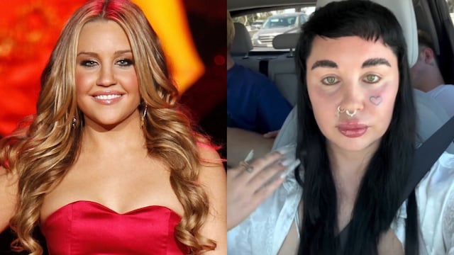 El antes y después de Amanda Bynes a lo largo de los años