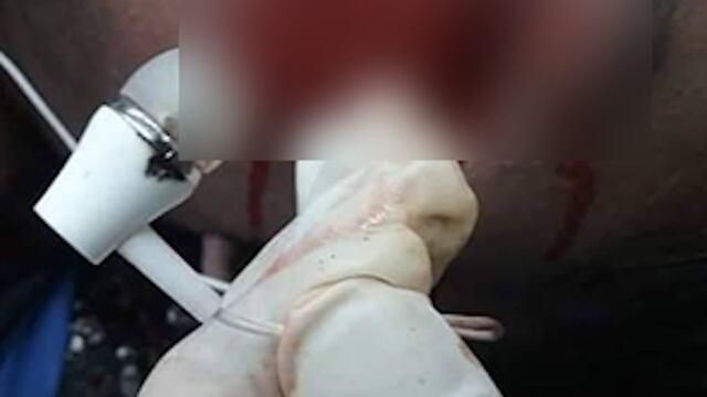Los audífonos involucrados en el accidente.