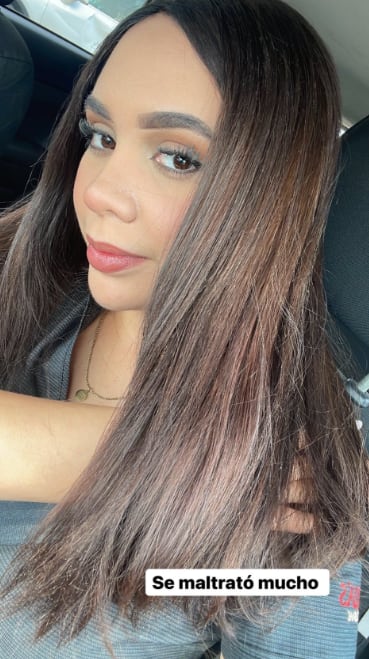 Quería ser rubia y terminó sin cabello