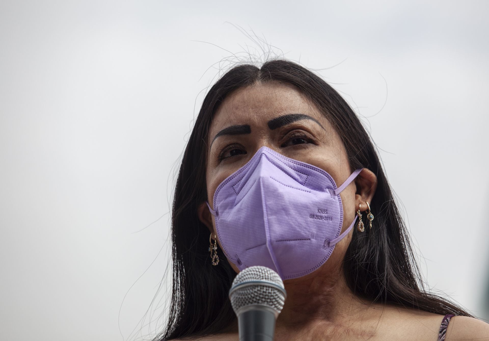 María Elena Ríos, activista y sobreviviente de ataque con ácido.
