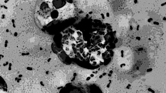 Imagen de referencia de la bacteria Burkholderia