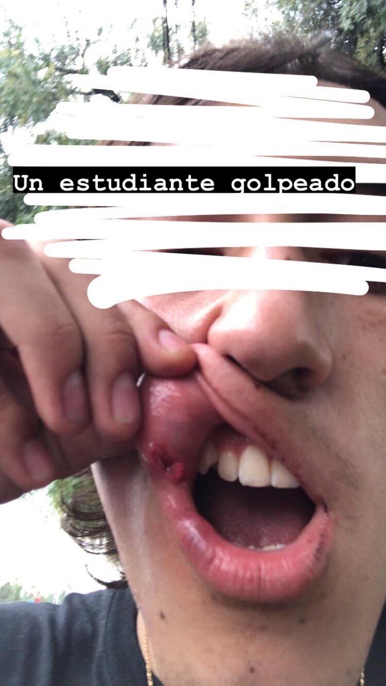 Estudiante golpeado por guardia de seguridad de la UNAM