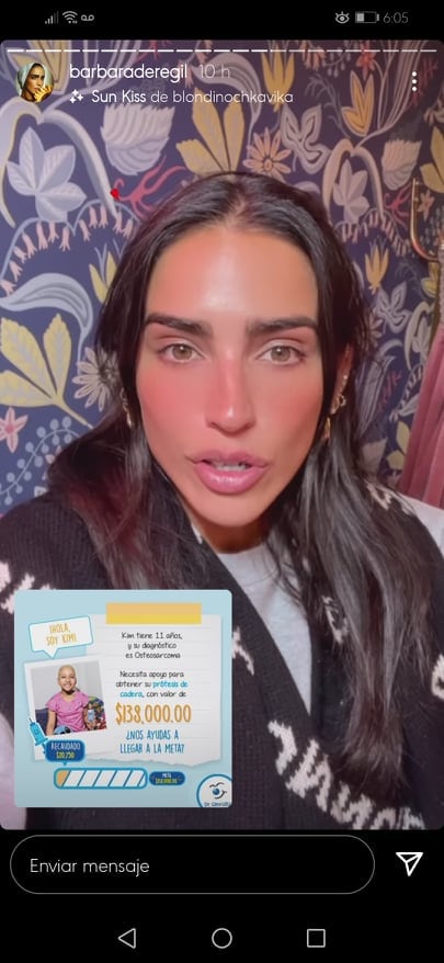 Bárbara de Regil pide ayuda para prótesis de niña.