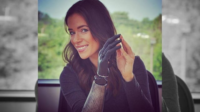 Conoce a Rebekah Marine, la modelo con brazo biónico que conquistó Nueva York