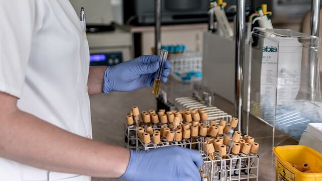 Pruebas de laboratorio