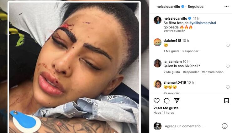 Yailin La Más Viral ¿golpeada?