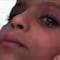 VIDEO: Niña que llora piedras causa asombro entre doctores