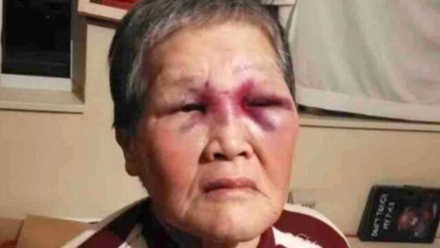Anciana agredida