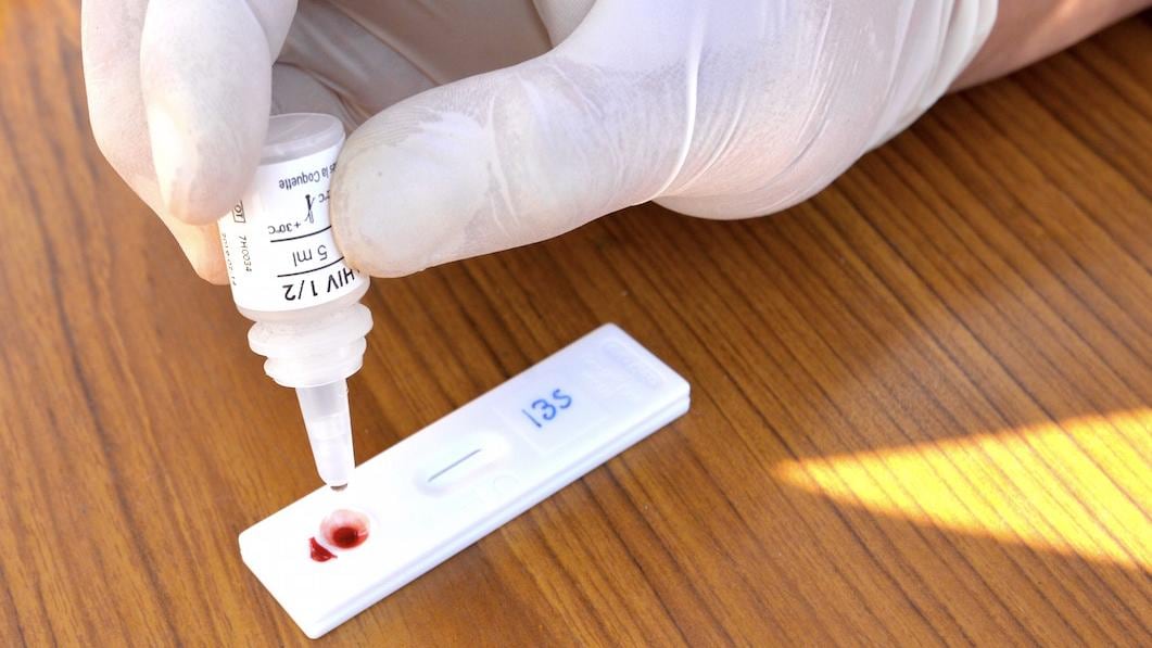 Virus de Inmunodeficiencia Humana (VIH).