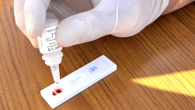 Curación del Virus de Inmunodeficiencia Humana (VIH).