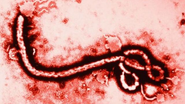 Así luce el virus del ébola.
