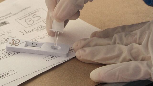 Prueba rápida de Covid-19 en México