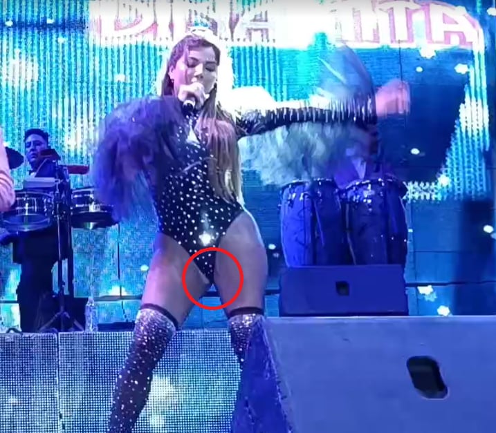 Aleida Núñez sufre accidente en el escenario.