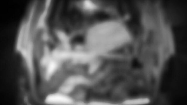 Cuerpos mutilados en Xalapa, Veracruz