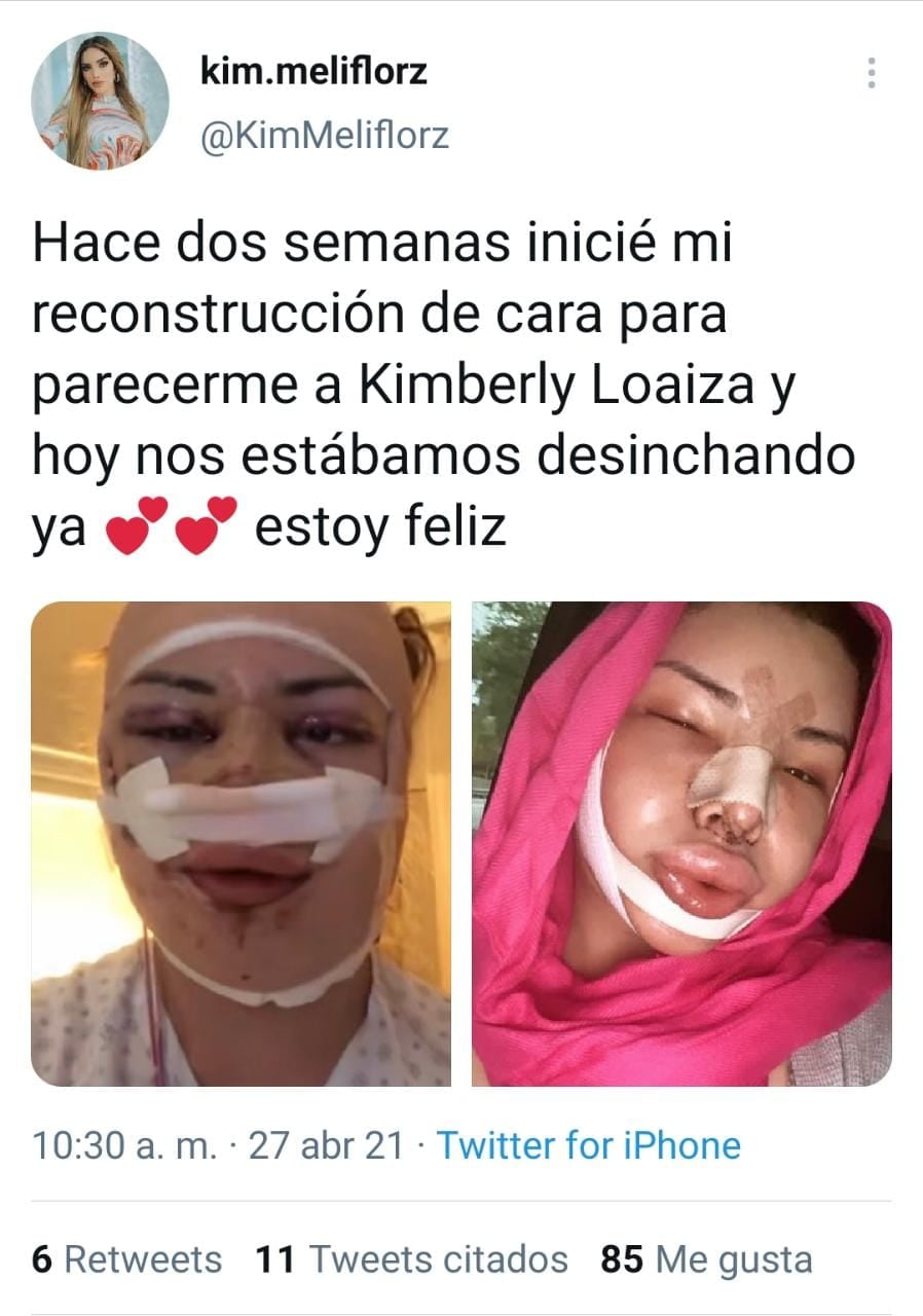 Publicación de Twitter - @KimMeliflorz