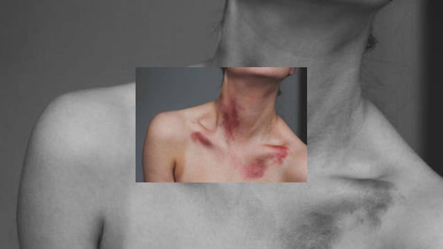 Chupetones.... ¿Buenos o malos para la salud?