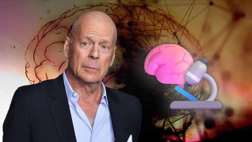 El cerebro de Bruce Willis será donado a la ciencia cuando muera