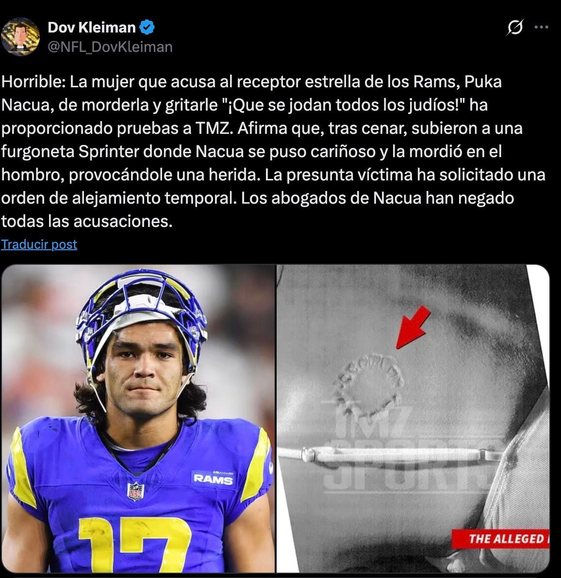Polémica en la NFL: acusan a Puka Nacua de morder a una mujer y lanzar comentarios antisemitas.