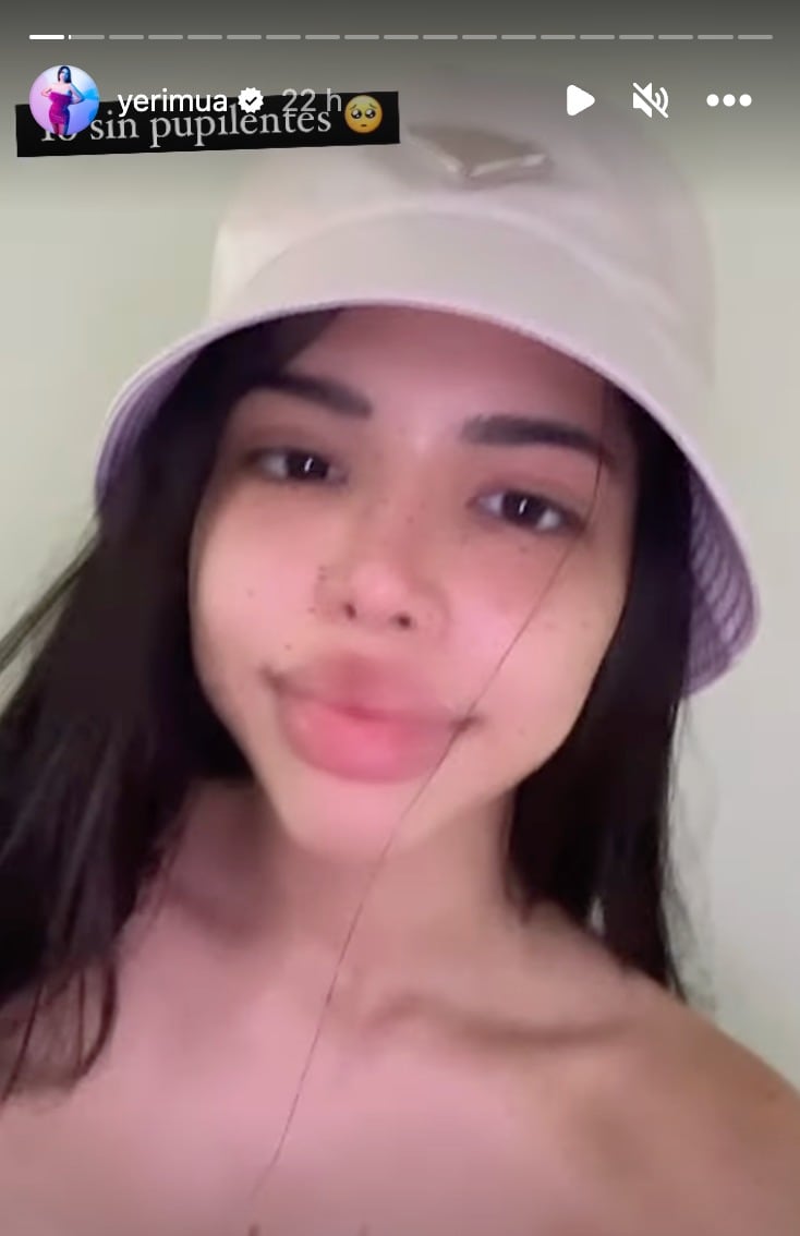 Yeri Mua sin maquillaje