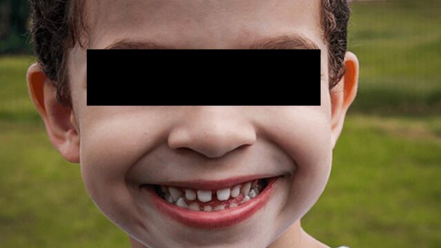 Extraen 500 dientes a niño.