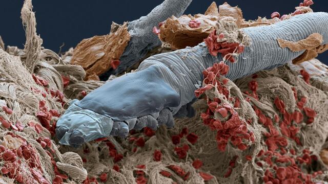 Los ácaros en la piel de la cara serían los primeros simbiontes del ser humano