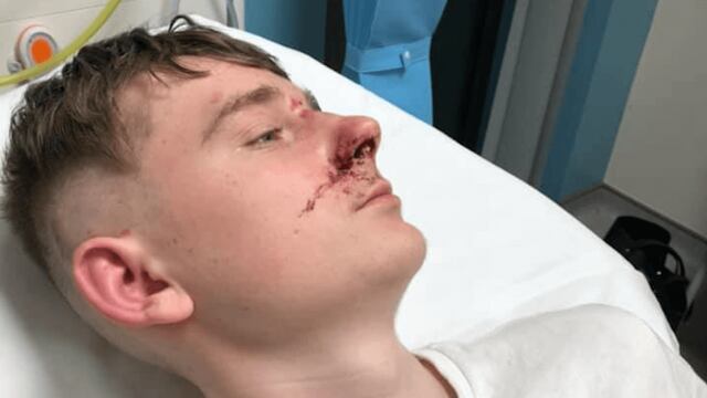 Jack Roberts, la víctima.