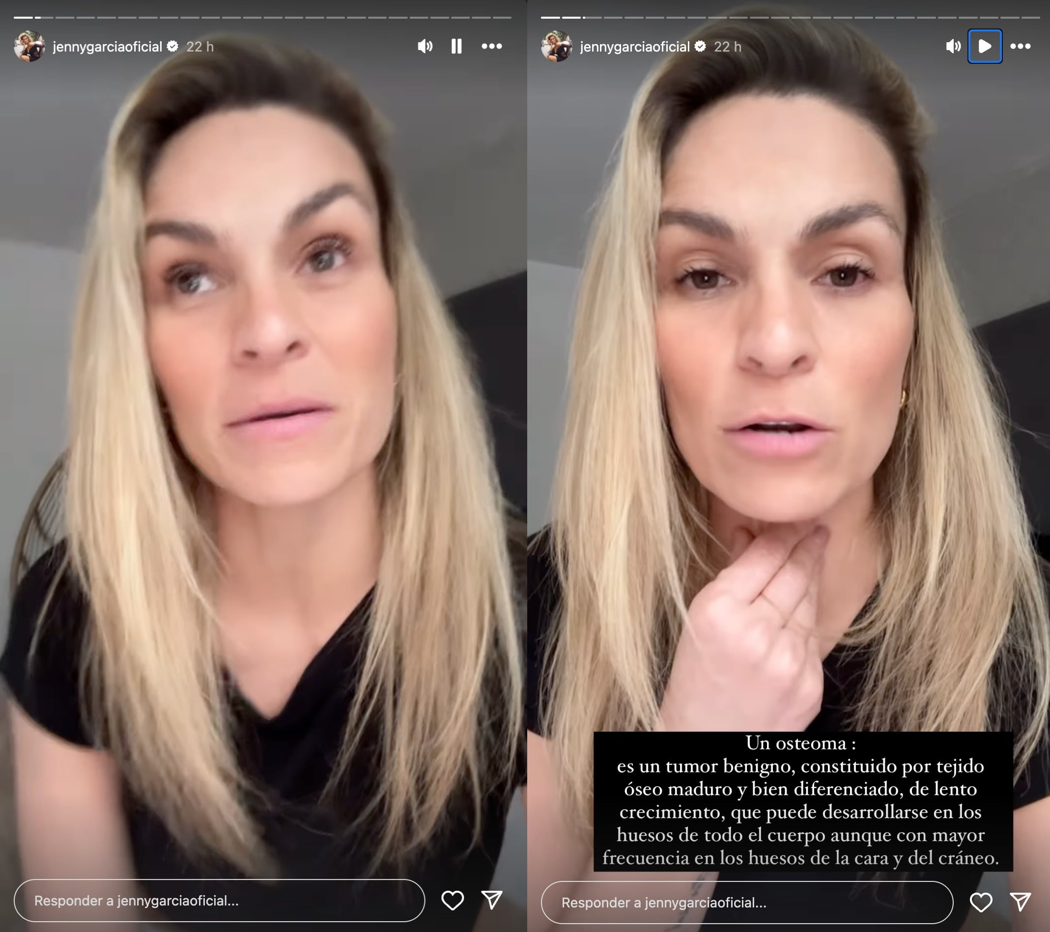 Jenny García revela que tiene un tumor en la frente