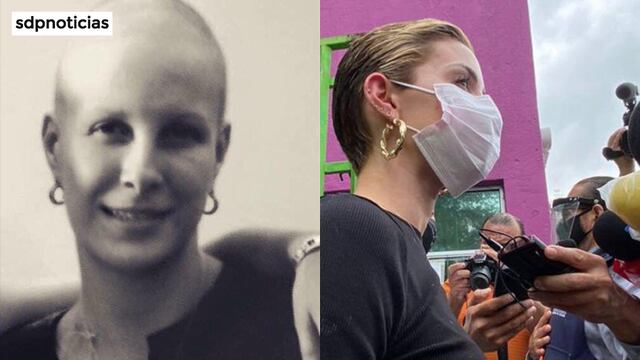 La autora, sin cabello por el cáncer; Mariana y la burla de su corte chic