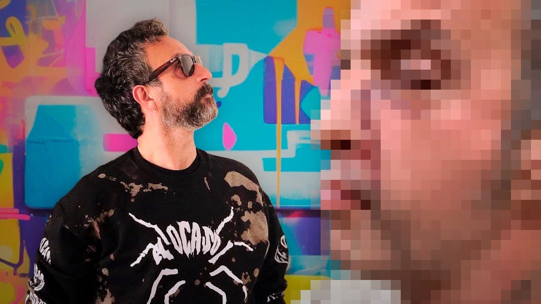 Tito Fuentes revela cómo luce su rostro tras 11 cirugías: “Así se ven las heridas del corazón”