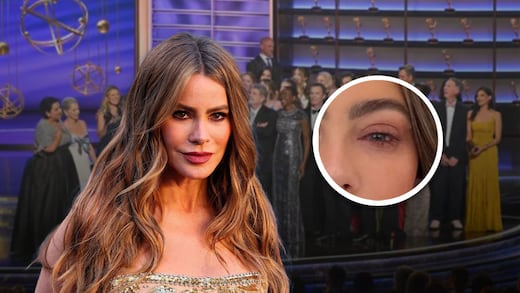 Sofía Vergara no asistió a los Premios Emmy 2025 por una fea infección en el ojo