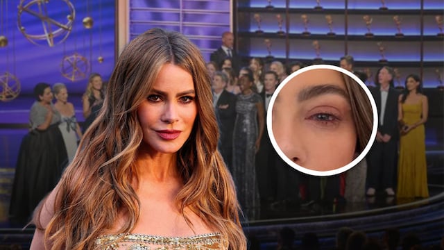 Sofía Vergara se pierde los Premios Emmy 2025 tras infección en el ojo