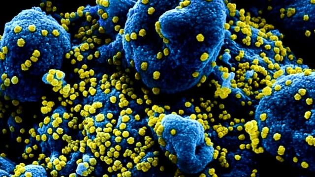 Fotos muestran cómo ataca el coronavirus a las células humanas