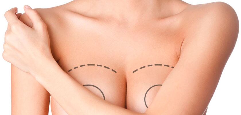 ¿Qué es el Mommy Makeover? La tendencia entre mujeres que se convirtieron en mamás