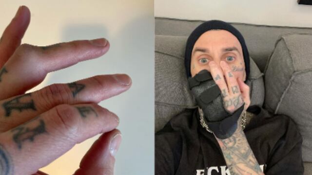 Lesión Travis Barker