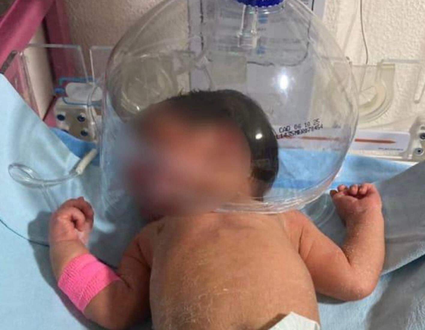 Hospital del IMSS Bienestar en Macuspana, Tabasco atiende a bebé con botella de plástico