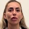 Florencia Alduncin muestra fotos de las 43 lesiones en su cuerpo por supuesto abuso de policías en Querétaro
