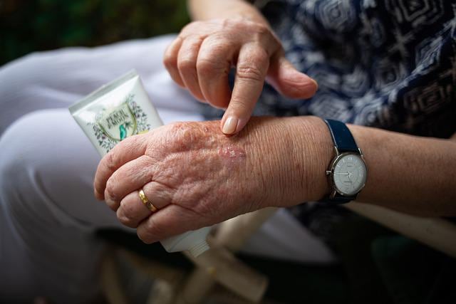Dolor en las manos