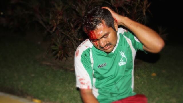 Alarma a AI uso de la fuerza contra manifestantes en México